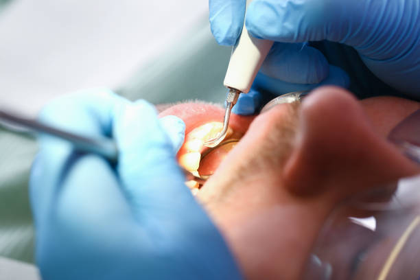 Best Pediatric Emergency Dentist in Perezville, TX
